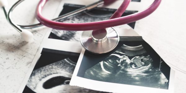 In the pictures of the ultrasound 4 weeks of pregnancy and 20 weeks is a phonendoscope. The concept of the study of pregnancy. Observation Selective focus